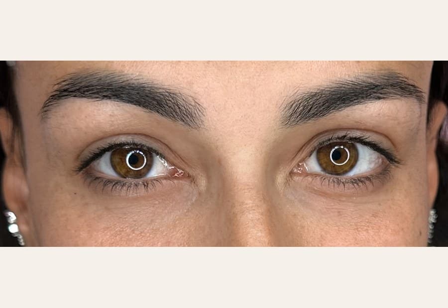 Microblading, After